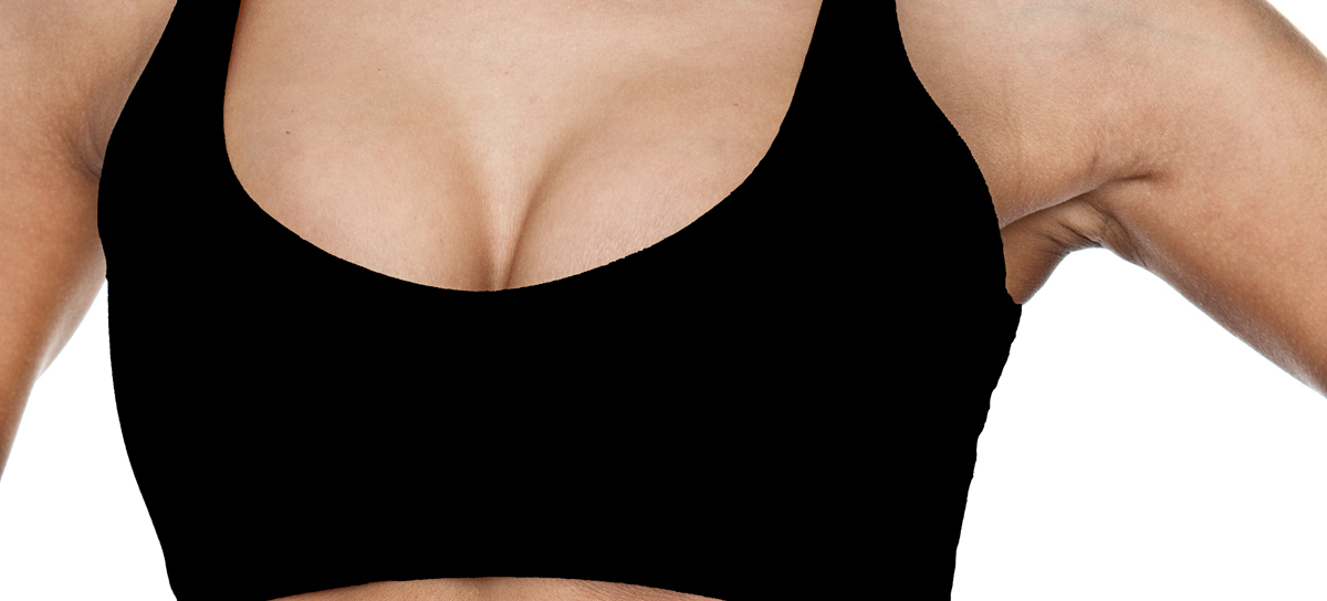 Breast Reduction Techniques